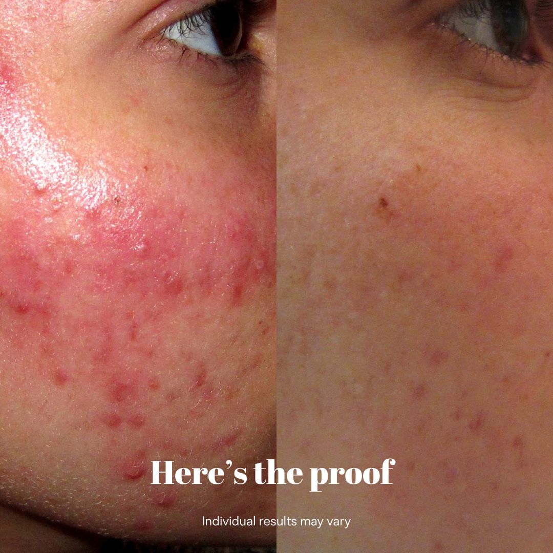 Copper Peptide Recovery Serum - GHK-Cu Formula