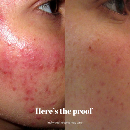 Copper Peptide Recovery Serum - GHK-Cu Formula